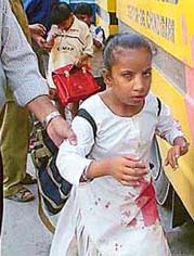 An injured blind child being taken for treatment after his school bus collided with a Haryana Roadways bus
