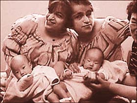 A file photograph of Iranian twins Laleh and Ladan with four-month-old Korean twins 