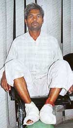 Joginder shows the bandaged feet that received burns after a cooking gas stove caught fire in Chandigarh on Sunday.