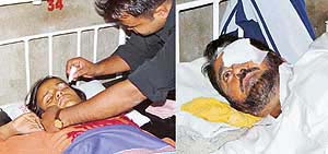 Sonali of Chandigarh and Sarwan Singh of Sangrur, who were admitted to the PGI, Chandigarh, after they were injured in accidents involving firecrackers