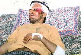 Padam Kant Dwivedi, who was injured when a stray cow hit his scooter on Sunday