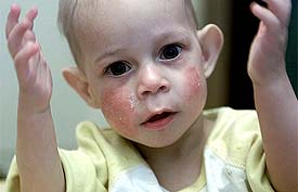 One-year and eight month old Nikita Druzhkov, one of the 37 children housed in a special orphanage for HIV-infected children, plays at St. Petersburg in Russia