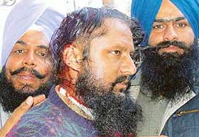 Jatinder Singh Randhawa, Youth Akali Dal vice-president, injured after the lathicharge at Ropar