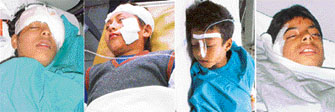 Injured schoolchildren admitted to Dayanand Medical College and Hospital 