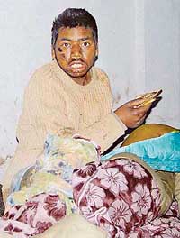 An unidentified man, who remained out in the open for three days near the PCA Stadium in Mohali