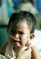 A year-old baby suffering from dengue fever cries