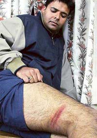 Rohit Sharma shows an injury mark