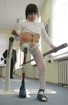 Zita Rezakhanova learns to walk with a prosthetic leg at Filatov children's hospital in Moscow 