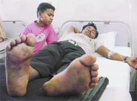 Umesh Kumar, who was allegedly tortured at a hotel in Ludhiana