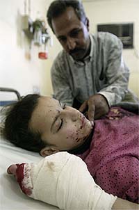 Iraqi schoolgirl Sara Abdullah (12) lies in a hospital with blood stains on her face, after she was shot in the hand and leg following the bombing of a US Army vehicle in Baghdad