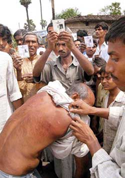 A voter shows his injury marks