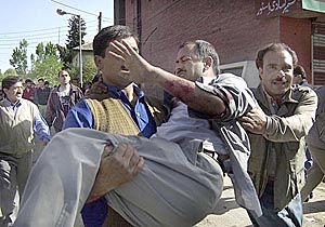 Kashmiris help injured photojournalist HU Naqash after a grenade explosion outside a local newspaper office in Srinagar on Monday. 