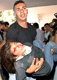 A man carries a wounded schoolgirl after an Israeli missile struck a house in Gaza 