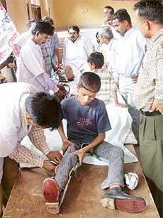 Helping them to rise on their feet --- a team from the Viklang Sahayata Kendra, Ludhiana, helps a patient put on calliper shoes at Satya Narayan Mandir, Sector 22, Chandigarh