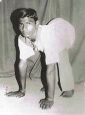 (BEFORE): Polio-ridden Sukhwinder Singh of Daman Heri village in Punjab.