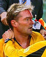 Blood drips from the forehead of Swedish referee Anders Frisk after an object thrown from the stands hit him during the Champions League soccer match