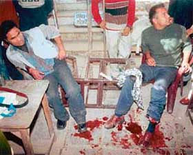 Amit Kumar, who was knifed on his legs and thigh, at the Patiala court complex