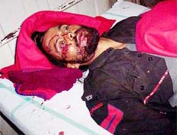 A Punjab Police Commando admitted to Government Rajindra Hospital after the Gypsy in which CM's security staff was travelling met with an accident near Bhawanigarh