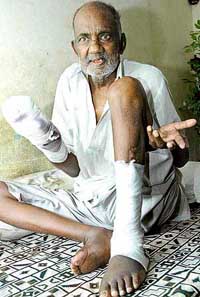 Former swing bowler Devi Chand rues his pathetic condition at his �home� in Sector 21 in Chandigarh