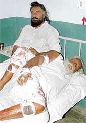 The farmers who were injured in a clash at Nanbera village on Friday.