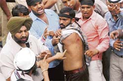 A teacher hurt during a lathi-charge shows his injuries in Kapurthala on Wednesday. Tribune photo: Pawan Sharma