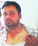 Harpreet Singh shows the injury marks he got after alleged police beating