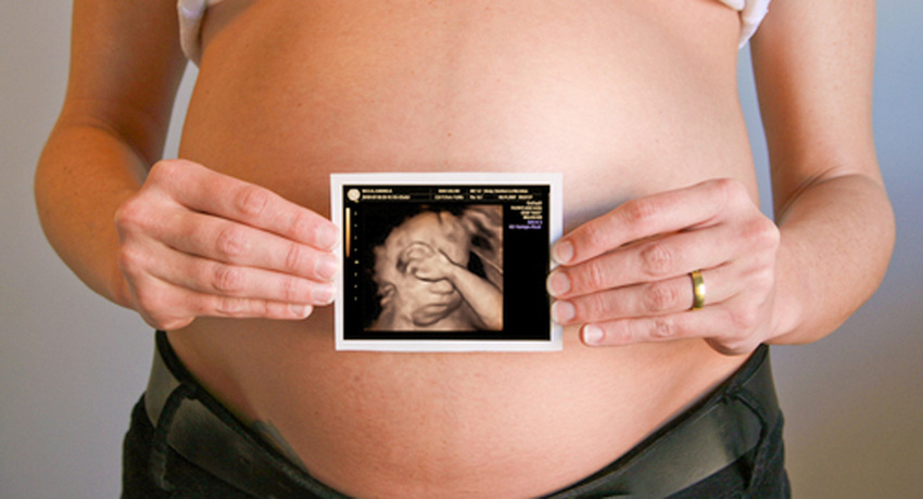 Pregnant mother with an ultrasound image