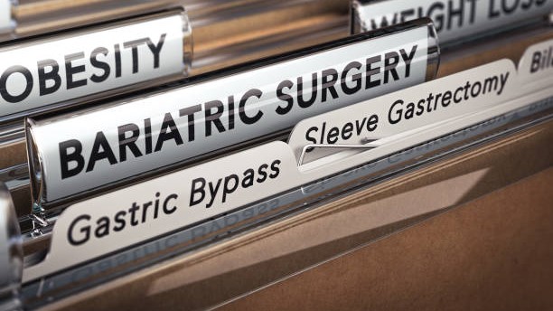 3D illustration of a folder with focus on a tabs with the texts bariatric surgery, gastric bypass and sleeve gastrectomy. Types of surgical operation used for obesity.