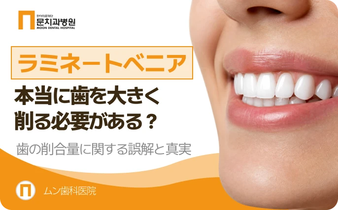 ラミネート, 歯をそんなにたくさん削らなければなりませんか？