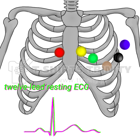 12誘導心電図 デザインtシャツ通販 Tシャツトリニティ