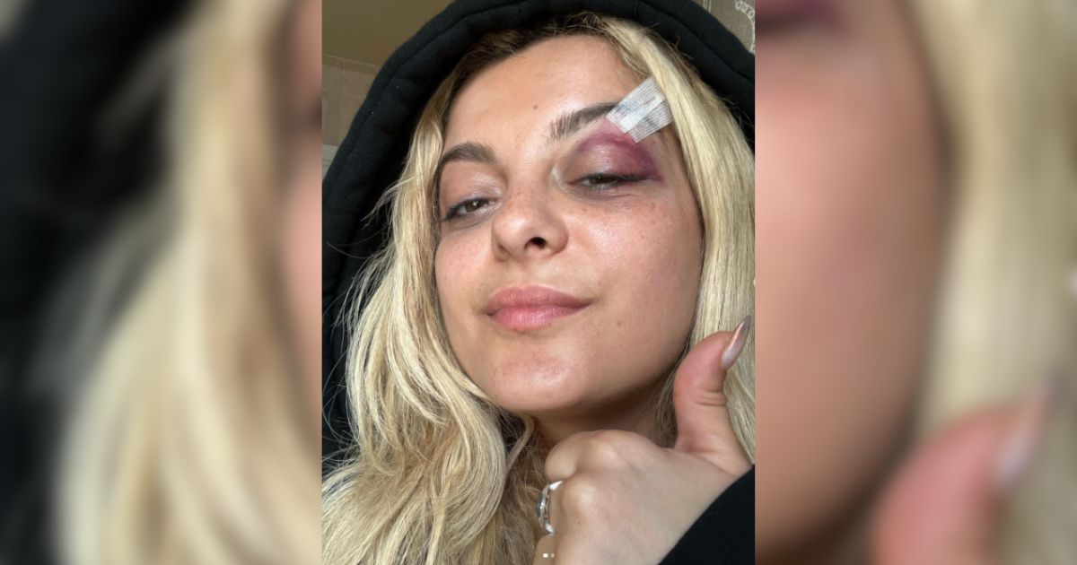 Bebe Rexha golpeada