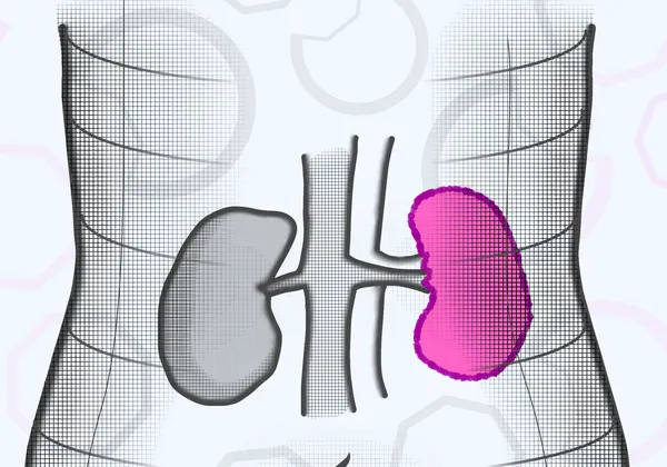 A person's outline with their kidneys visible. One kidney is pink, while the rest of the body is black and white.