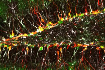 Image of newly made neurons in the brain