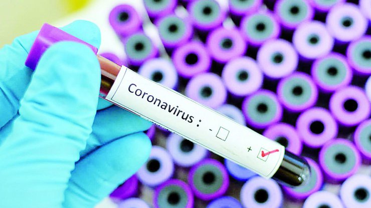 UAE reports 462 new cases of Covid-19