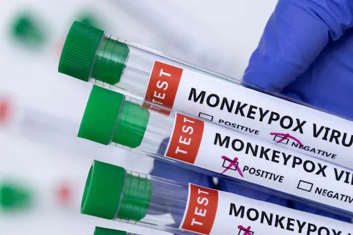 Monkeypox: Kerala steps up vigil, issues special alerts to five districts