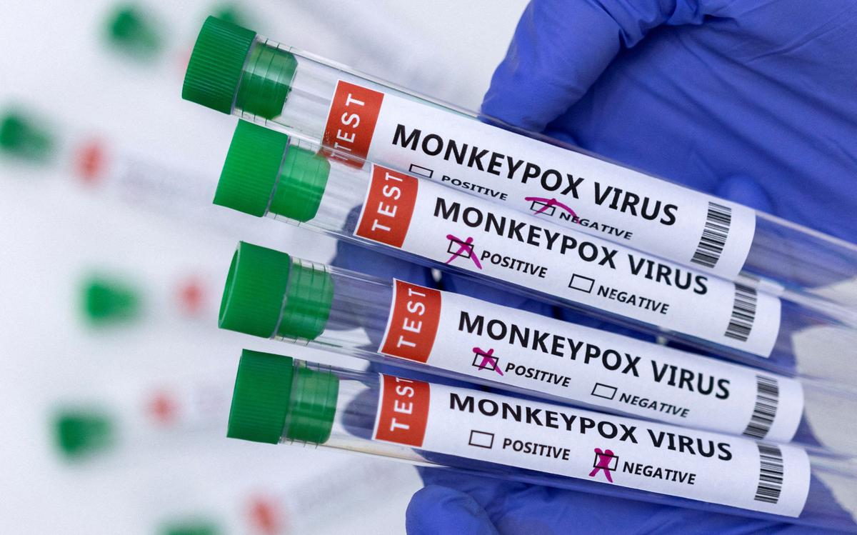 Monkeypox spreads in 75 country; What you should know about monkeypox
