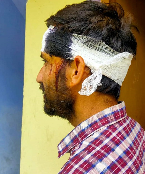 चमोली: डॉक्टर ने तिमारदारों पर लगाया मारपीट का आरोप, छह के खिलाफ दी तहरीर–