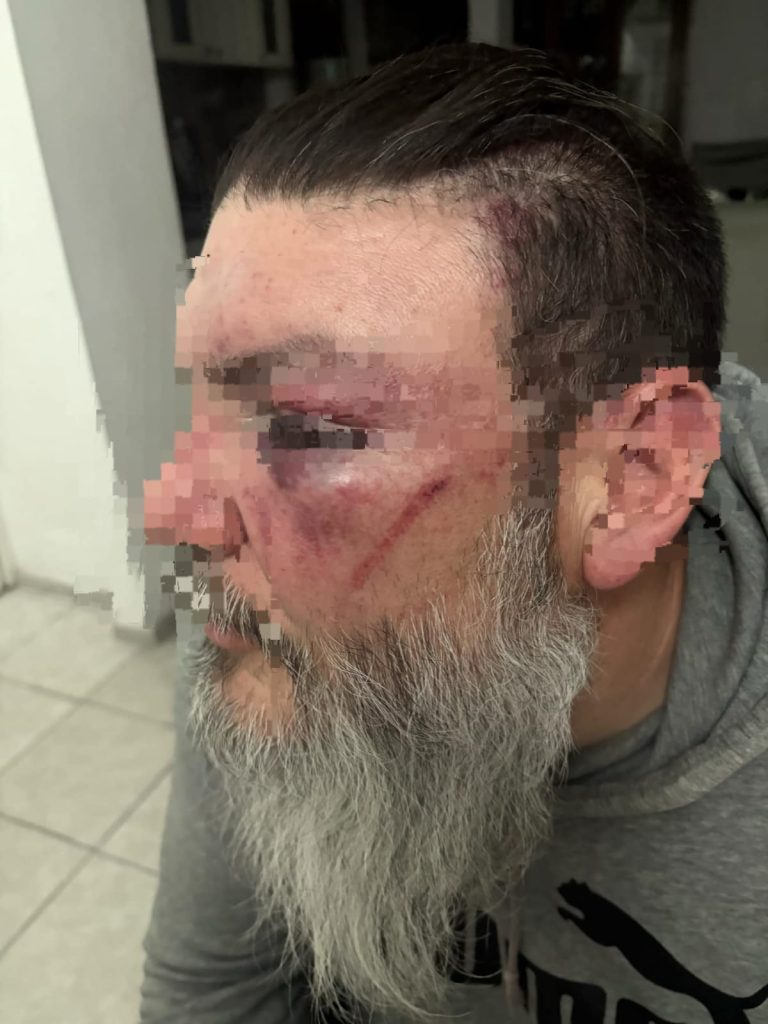 Brutal agresión a productor en el Pumas vs Cruz Azul