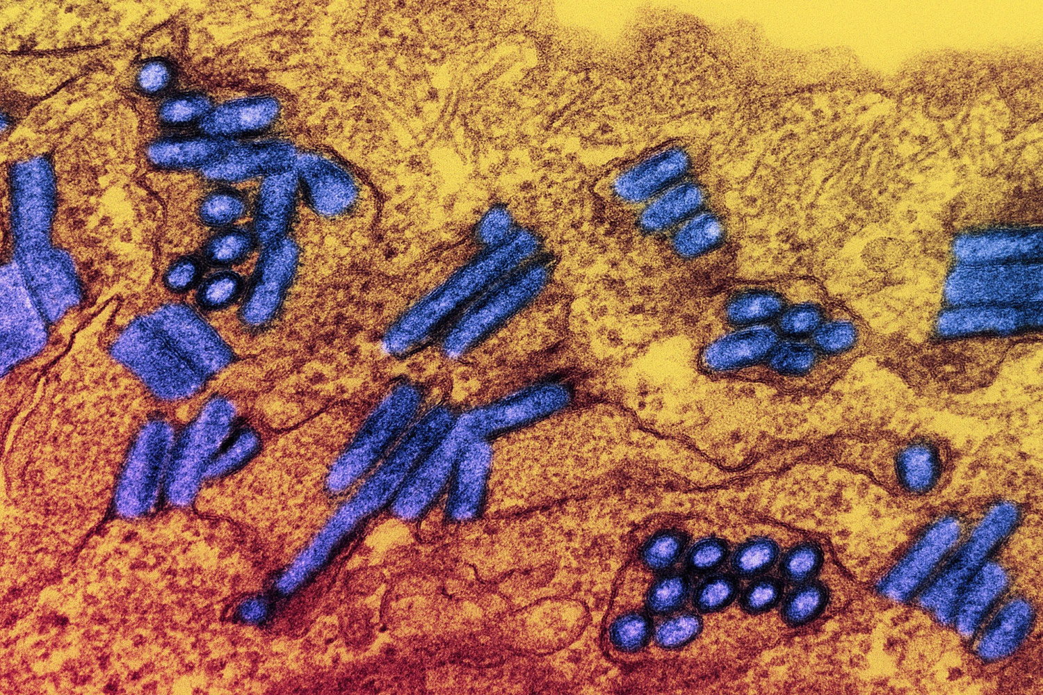 Particle News: Rabies Confirmed as Cause of Death in Michigan Organ ...