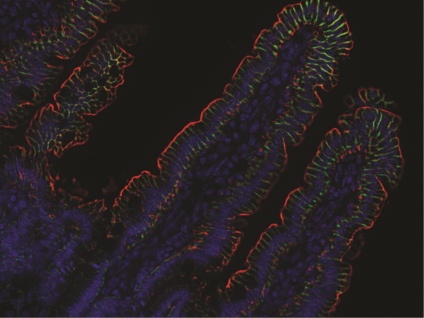 Particle: NSAIDs Strengthen Gut’s Parasite-Fighting Immune Pathway