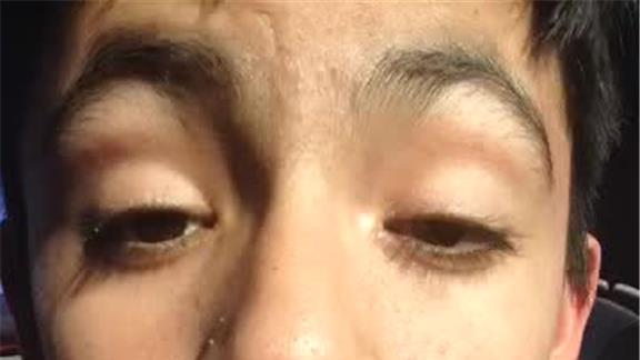 Most Winks In 30 Seconds