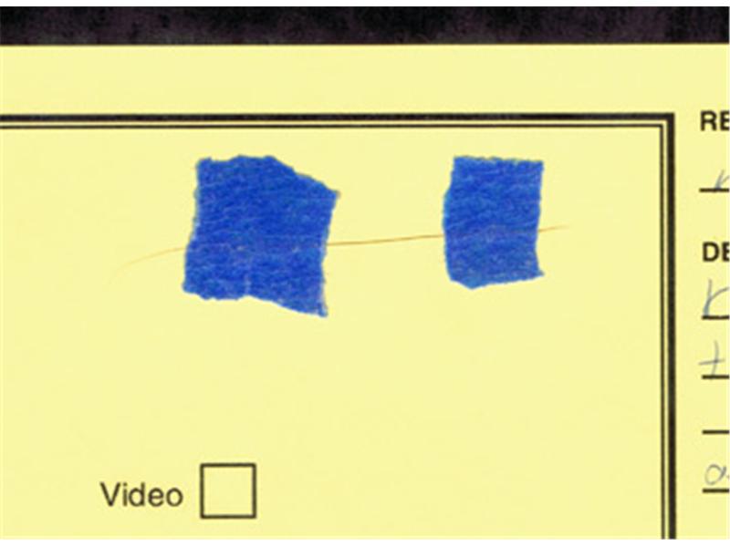 Longest Underarm Hair (Female)