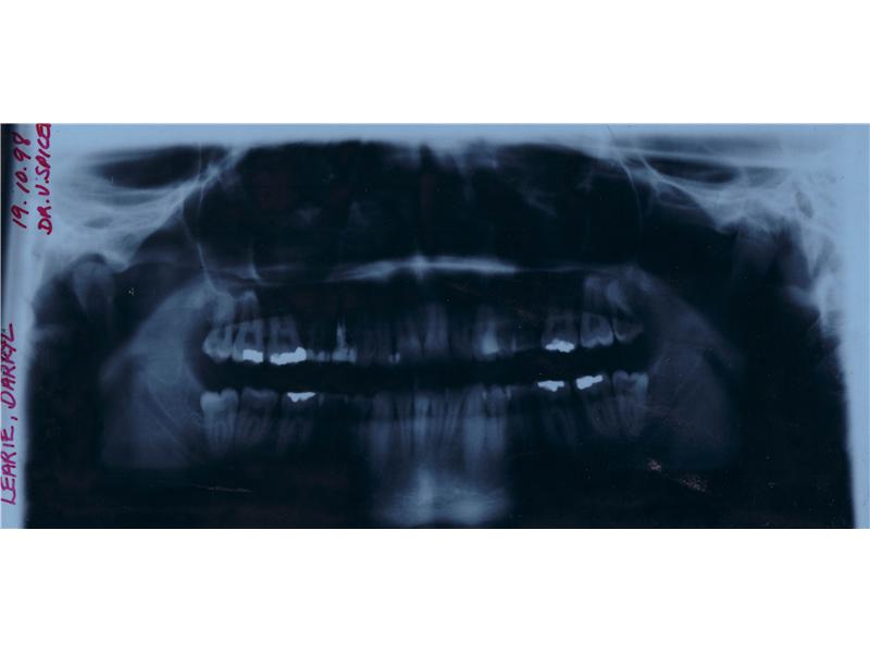 Largest Collection Of Personal X-Rays