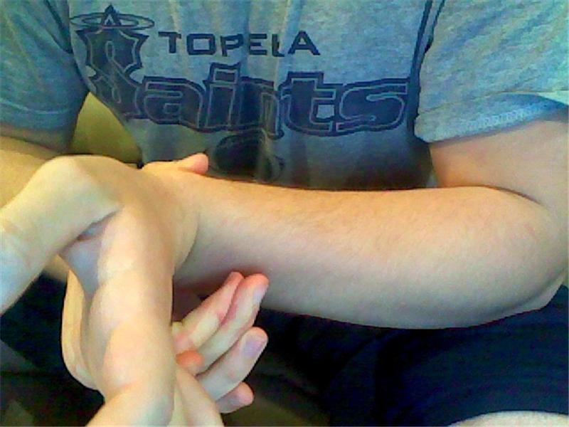 Most Fingers Bent Backwards To Touch One\'s Own Forearm