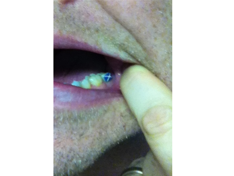 Longest Time To Wear A Scotland Flag Tattooed On Tooth