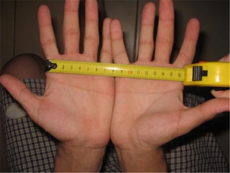Longest Single Transverse Palmar Crease Across Two Hands