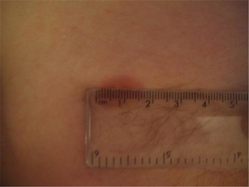 Smallest Nipple (Male)