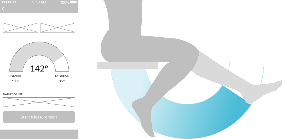 LEFT: Lifestyle Medical's initial concept for the measurement functionality was arc-shapedRIGHT: I proposed to change it to an inverted arc as this was visually more similar to the knees' range of motion. The legs (normally) do not bend the other way.