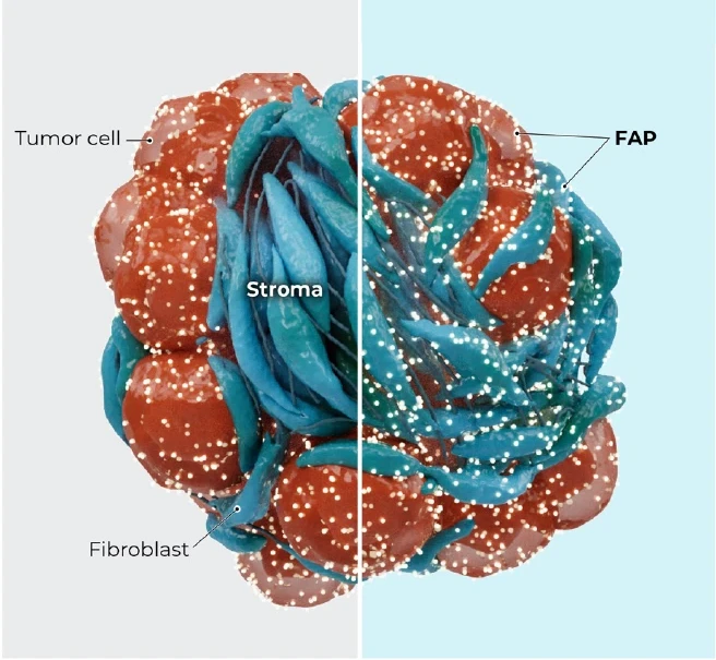 Tumor stroma cells do not typically express cancer-specific markers like SSTR2 or MC1R. FAP is primarly expressed on tumor stroma cells, but also on some cancer sells.