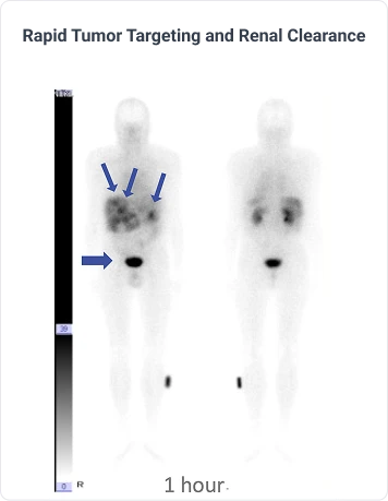 Rapid Tumor Targeting and Renal Clearance